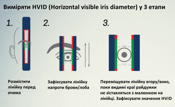 Виміряти&nbsp;HVID&nbsp;(Horizontal visible iris diameter) у&nbsp;3 етапи